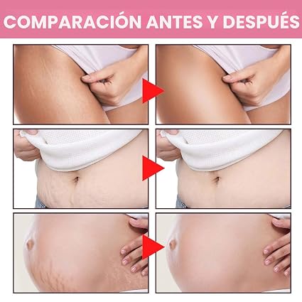 Adeus Crema Brasileña – Tratamiento Corporal Intensivo 300g