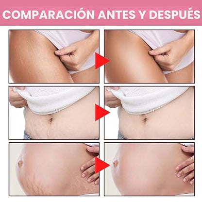 Adeus Crema Brasileña – Tratamiento Corporal Intensivo 300g