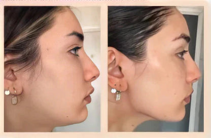 MASAJEADOR FACIAL MICROCORRIENTE