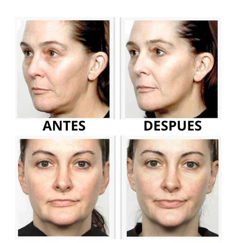 MASAJEADOR FACIAL MICROCORRIENTE